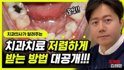 임플란트 치과치료 저렴하게 받는 방법 꿀팁